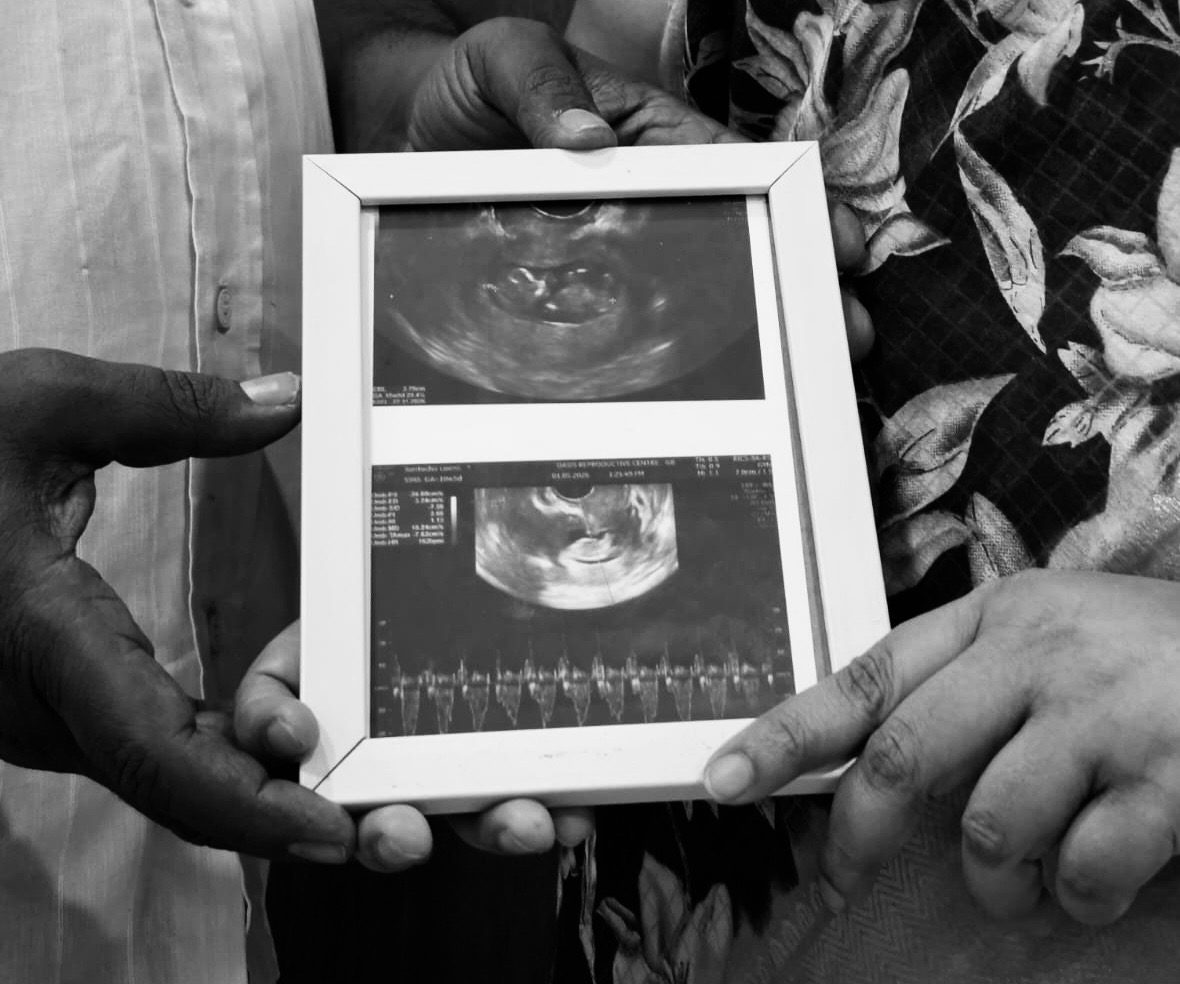 Is AGE just a number in fertility ?